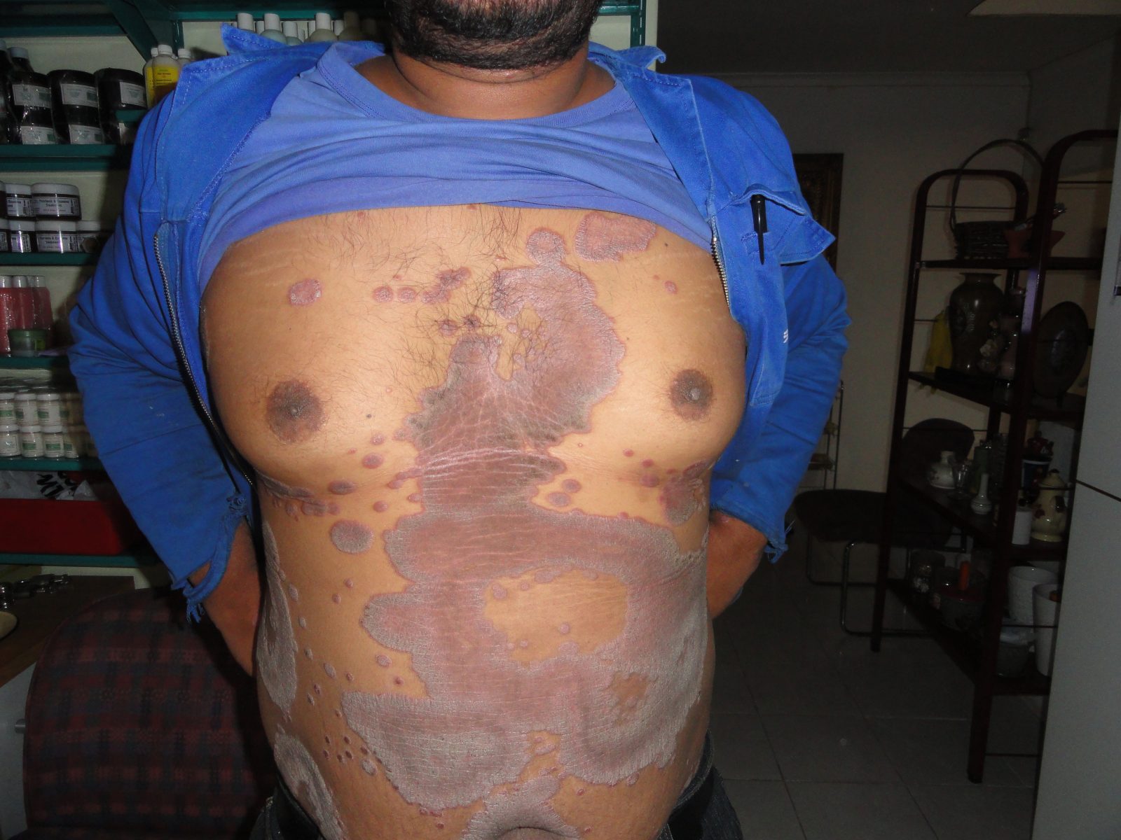 Herbal Force Skin Clinic