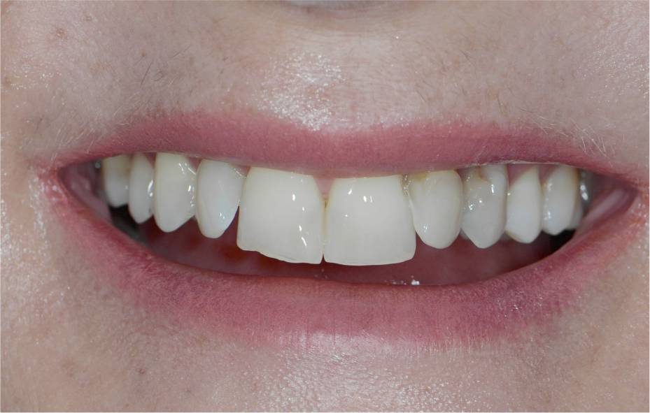 Dr. Adé Meyer Cosmetic Dentistry