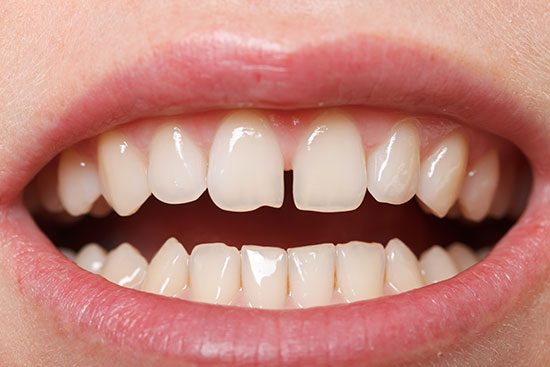 Ghabrial orthodontics